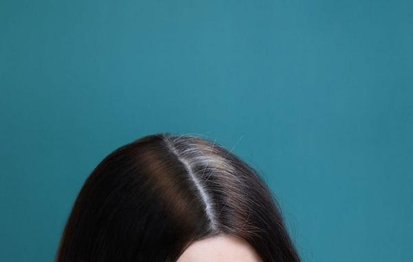 دانشمندان به راه حل احتمالی جدیدی برای جلوگیری از سفید شدن مو دست یافتند