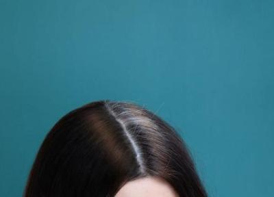 دانشمندان به راه حل احتمالی جدیدی برای جلوگیری از سفید شدن مو دست یافتند
